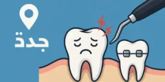 خلع ضرس العقل جدة: كل ما تحتاج إلى معرفته