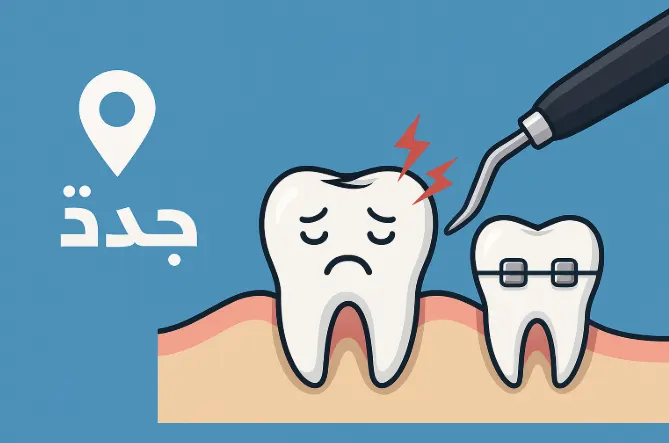خلع ضرس العقل جدة