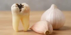 علاج تسوس الأسنان بالثوم؟ حقيقية العلاج بالثوم علاج تسوس الأسنان بالثوم؟ حقيقية العلاج بالثوم