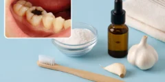 علاج تسوس الأسنان في المنزل: دليل شامل لحماية ابتسامتك علاج تسوس الأسنان في المنزل: دليل شامل لحماية ابتسامتك