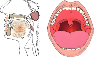 أنواع-تقرحات-الفم