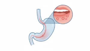 العلاقة بين أمراض الفم والمعدة