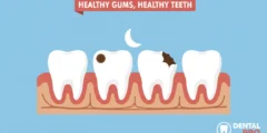 At-Home Tooth Filling