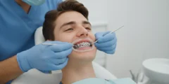 Dental Braces Installation: A Complete Guide 2026