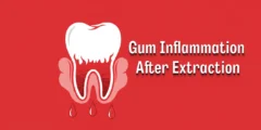 Gum Inflammation After Extraction: Causes, Prevention, and Treatment 2026
