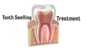 Tooth Swelling Treatment