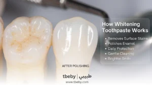 How Whitening Toothpaste Works