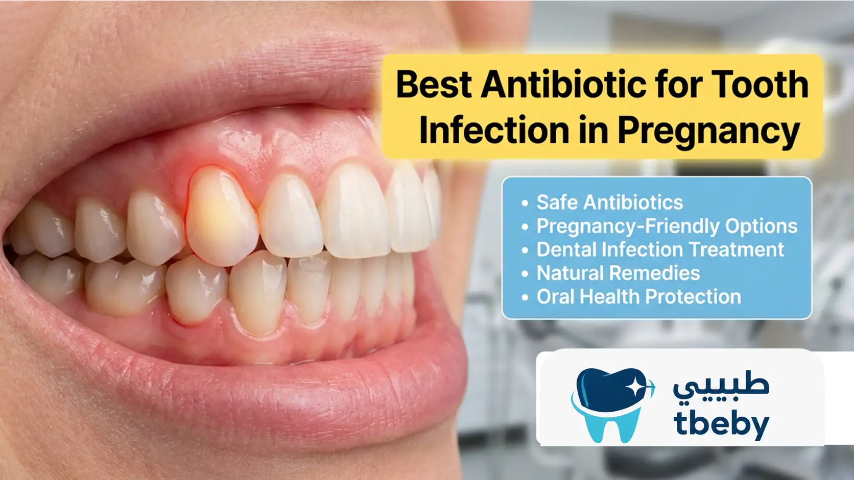 Best Antibiotic for Tooth Infection in Pregnancy 2026
