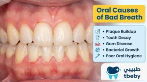 Bad Breath in Children: Primary Causes
