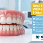 Best Teeth Whitening Strips: Benefits & Drawbacks 2026
