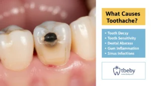 Causes of Toothache