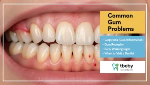 Common Gum Problems