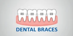 Best Orthodontist & Dental Braces Clinic 2026