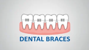 Best Orthodontist & Dental Braces Clinic in Jeddah