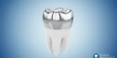 Dental Crown Prices 2026: Best Types, Costs & Complete Guide