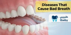 Diseases That Cause Bad Breath: Key Causes and How to Treat Them 2026