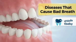 Diseases That Cause Bad Breath: Key Causes and How to Treat Them 2026