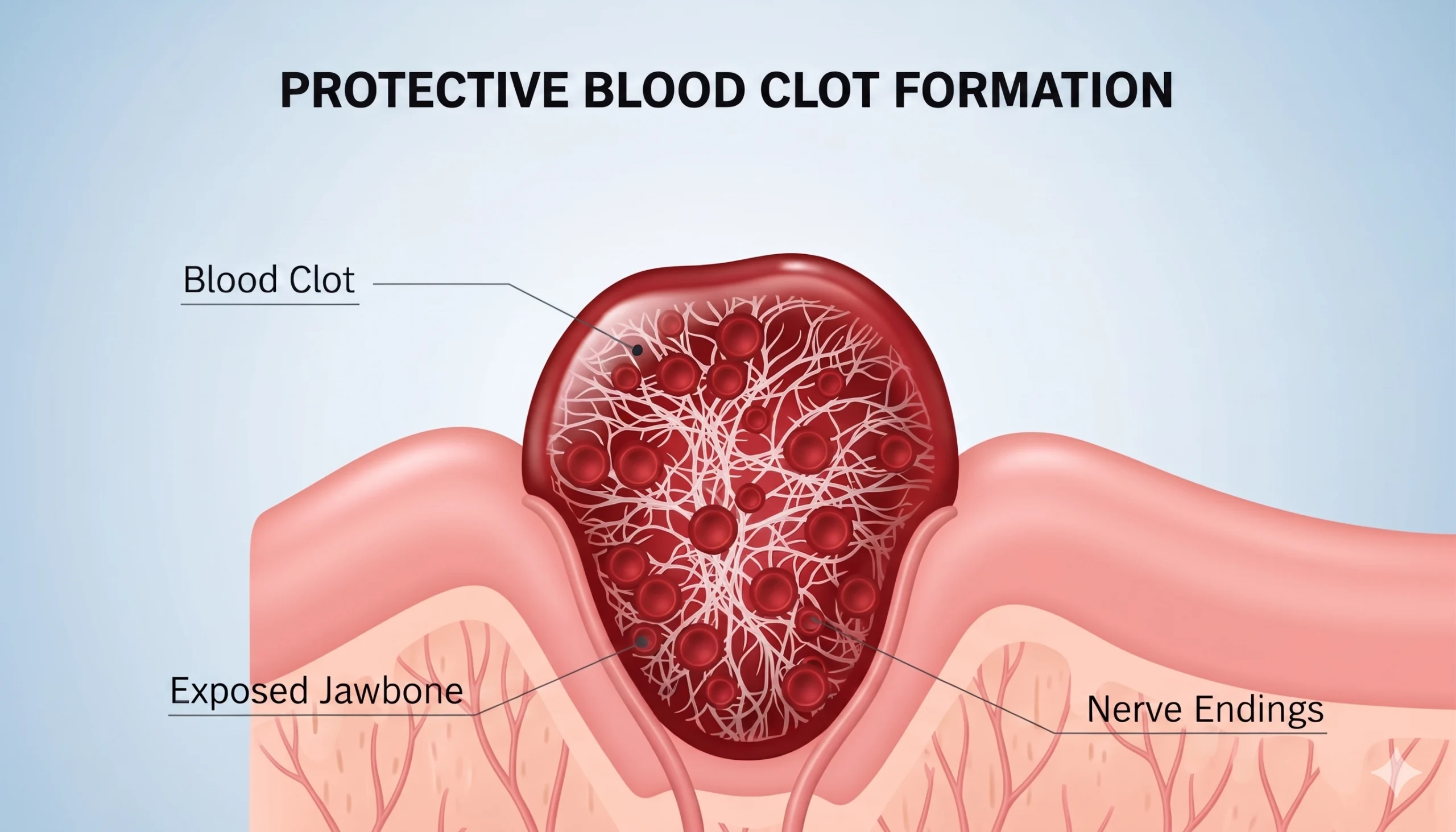 White Layer on Gums After Tooth Extraction: Causes & Treatment 2026
