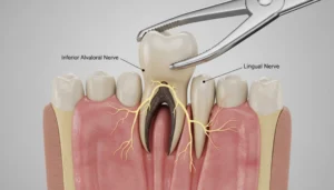 How Does Tongue Numbness Occur?
