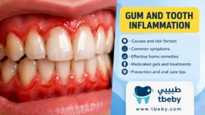 Best Medications for Treating Gum and Tooth Inflammation at Home in 2026