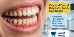 Oral and Dental Diseases: Treatment and Prevention The 5 Most Important Conditions