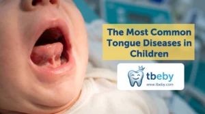 The Most Common Tongue Diseases in Children