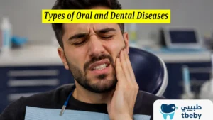 Types of Oral and Dental Diseases