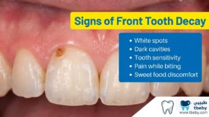 What Are the Warning Signs of Front Tooth Decay?