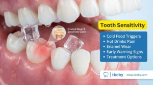 What Is the Best Antibiotic for Teeth?