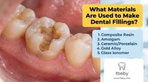 What Materials Are Used to Make Dental Fillings?