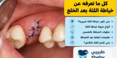 كل ما تعرفه عن خياطة اللثة بعد الخلع 2026