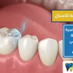 علاج حساسية الاسنان: أسباب وحلول فعّالة