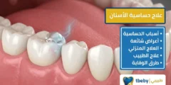 علاج حساسية الاسنان: أسباب وحلول فعّالة 2026