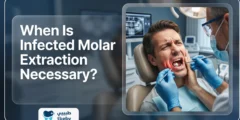 When Is Infected Molar Extraction Necessary? 2026