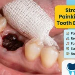 Strongest Painkiller After Tooth Extraction: 5 Natural Remedies to Relieve Pain