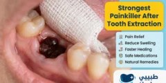Strongest Painkiller After Tooth Extraction:5 Natural Remedies Strongest Painkiller After Tooth Extraction:5 Natural Remedies