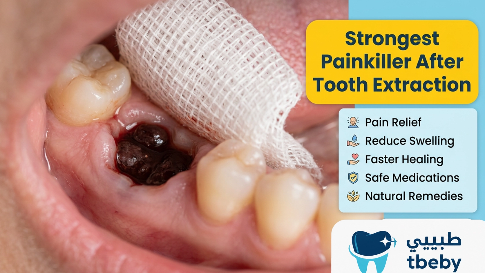 Strongest Painkiller After Tooth Extraction: 5 Natural Remedies to Relieve Pain