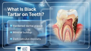 What Is Black Tartar on Teeth?