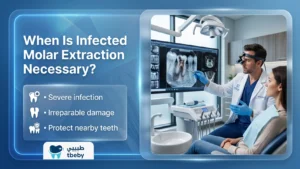 When Is Infected Molar Extraction Necessary?
