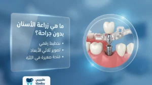ما هي زراعة الأسنان بدون جراحة؟