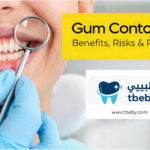 Gum Contouring: Benefits, Risks, Recovery 2026