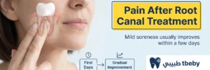 How Long Does Pain Last After Root Canal Treatment?
