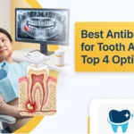 Best Antibiotic for Tooth Abscess: Top 4 Options