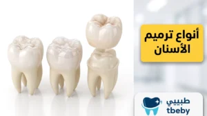 أنواع ترميم الأسنان