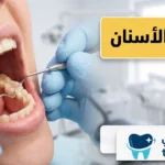ترميم الأسنان: دليلك لاستعادة السن وحماية الابتسامة