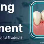 Bleeding Gums Treatment: Causes, Home Care and Dental Treatment