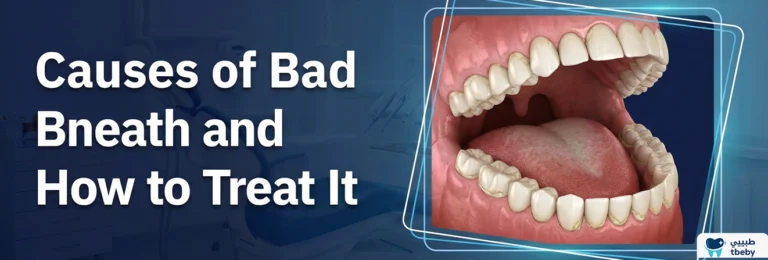 Causes of Bad Breath and How to Treat It