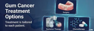 Gum Cancer Treatment Options