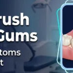 Oral Thrush on the Gums: Causes, Symptoms, and Treatment