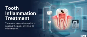 Tooth Inflammation Treatment: What Are Your Options?
